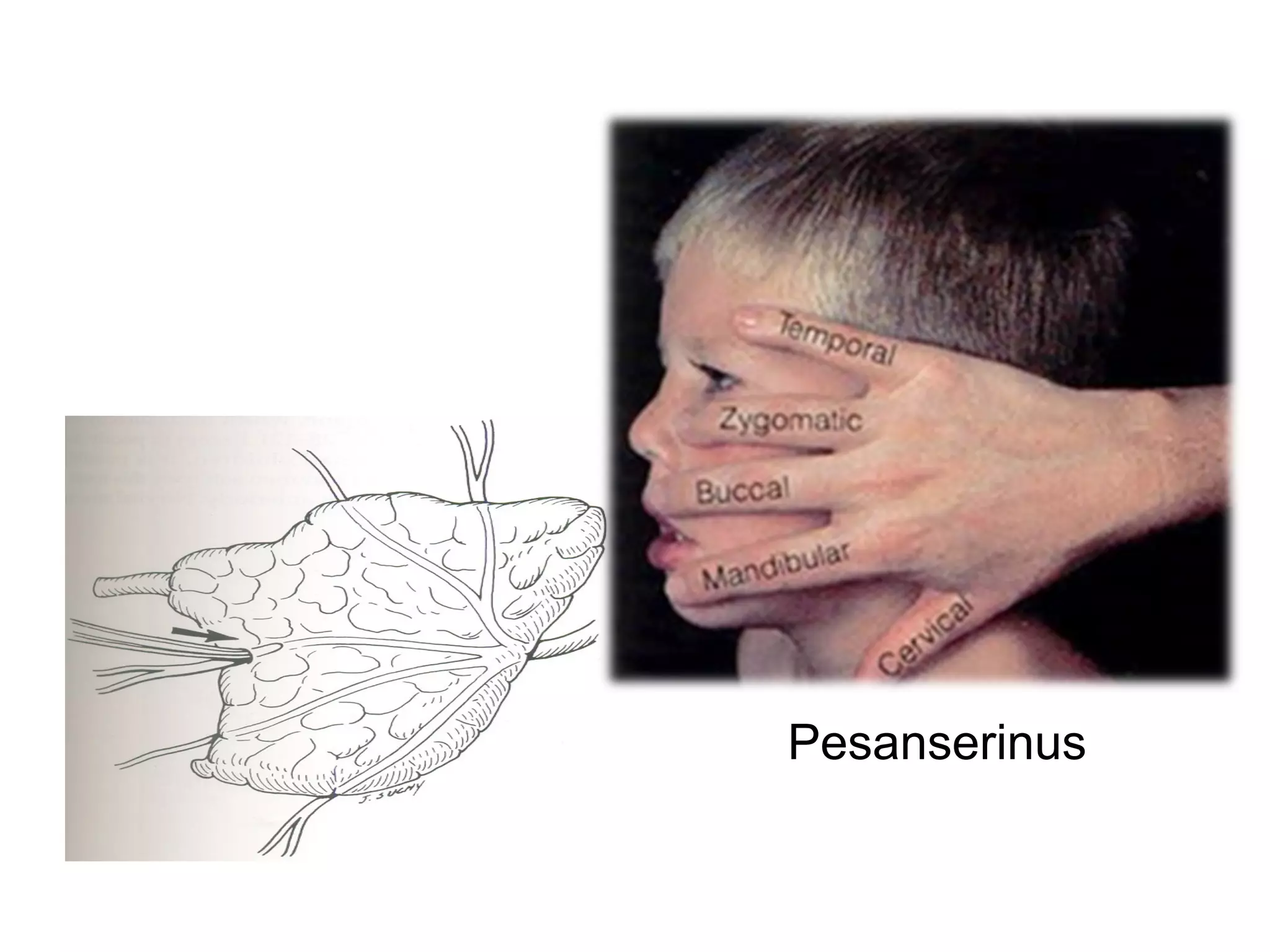 Pesanserinus
 