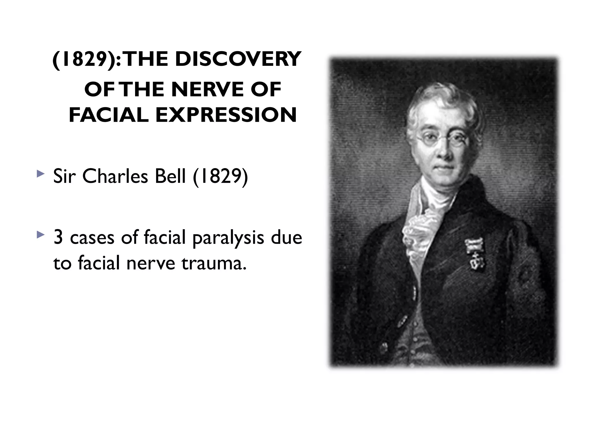 (1829):THE DISCOVERY
OFTHE NERVE OF
FACIAL EXPRESSION
 Sir Charles Bell (1829)
 3 cases of facial paralysis due
to facial nerve trauma.
 