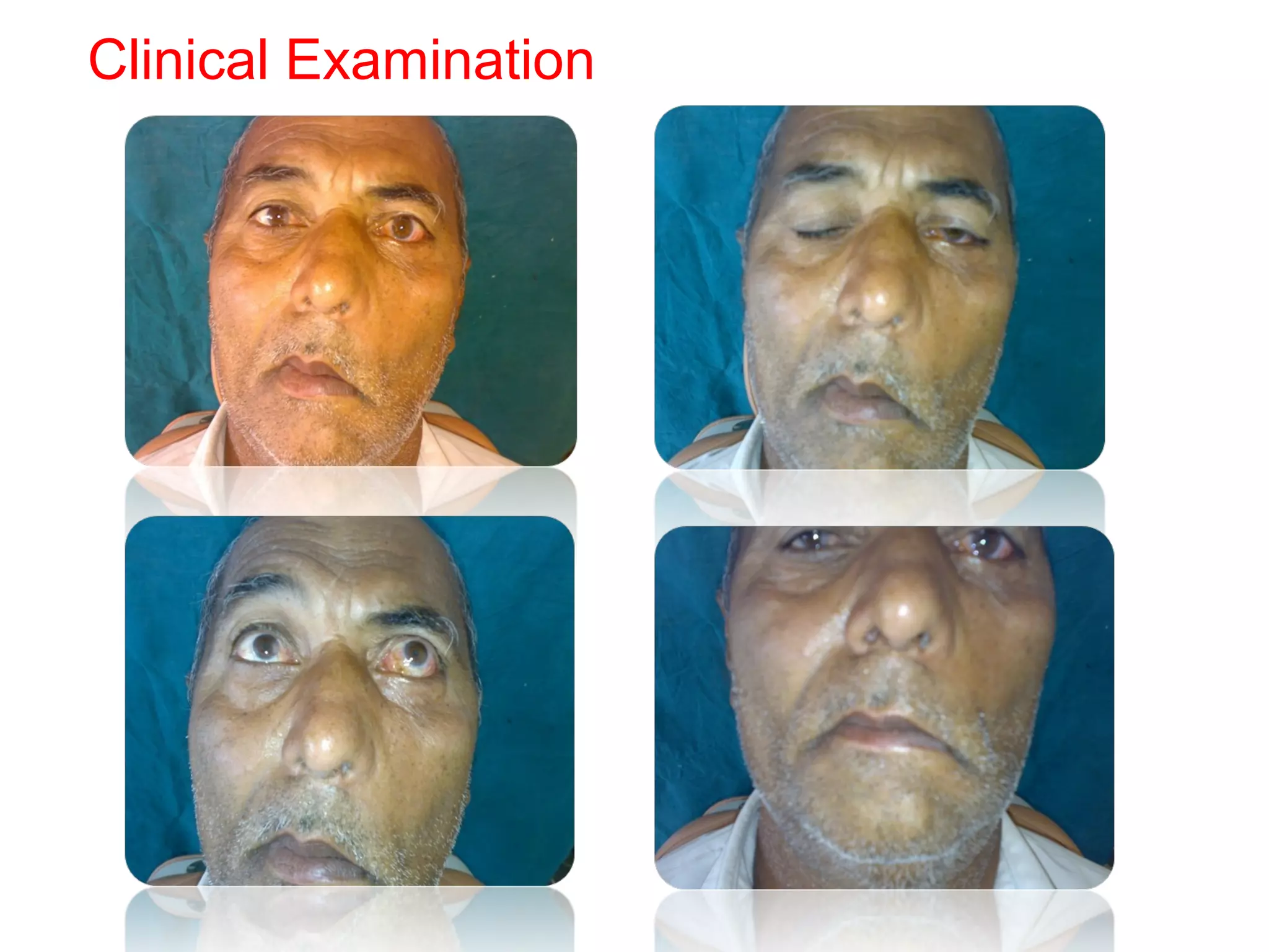 Clinical Examination
 