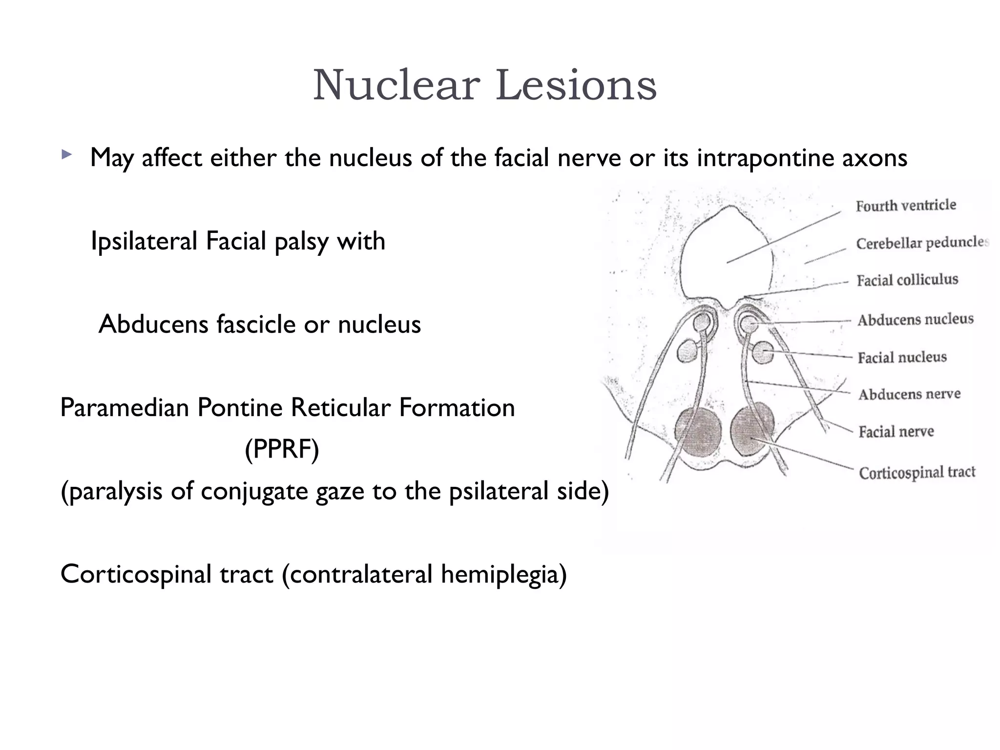 Nuclear Lesions
 May affect either the nucleus of the facial nerve or its intrapontine axons
Ipsilateral Facial palsy with
Abducens fascicle or nucleus
Paramedian Pontine Reticular Formation
(PPRF)
(paralysis of conjugate gaze to the psilateral side)
Corticospinal tract (contralateral hemiplegia)
 