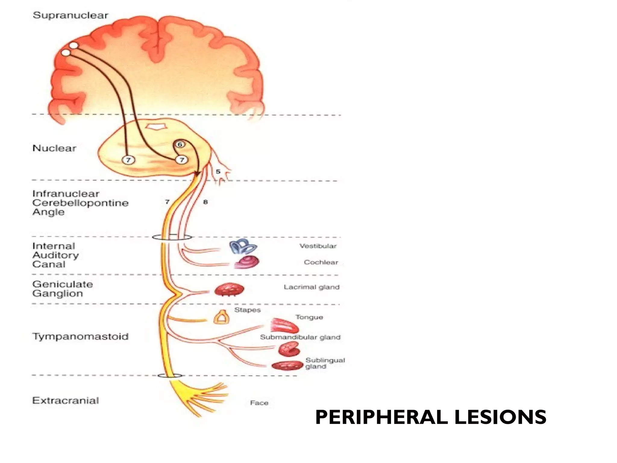 PERIPHERAL LESIONS
 