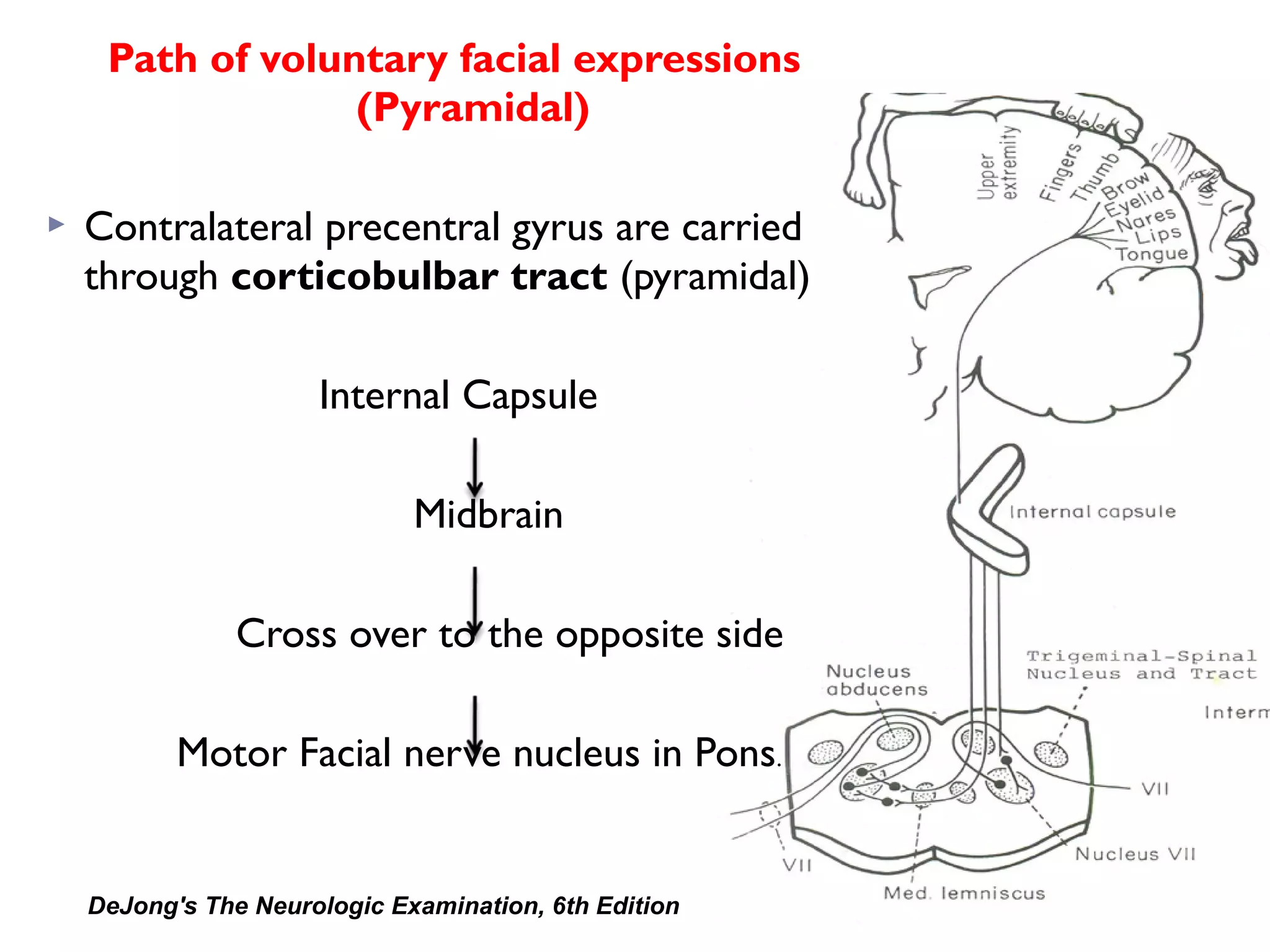 Path of voluntary facial expressions
(Pyramidal)
 Contralateral precentral gyrus are carried
through corticobulbar tract (pyramidal)
Internal Capsule
Midbrain
Cross over to the opposite side
Motor Facial nerve nucleus in Pons.
DeJong's The Neurologic Examination, 6th Edition
 