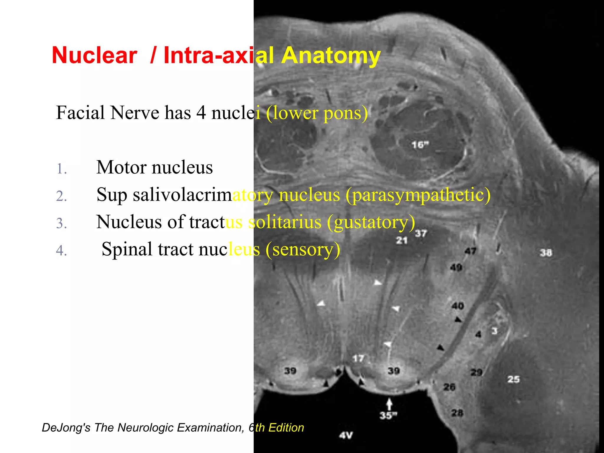 Facial Nerve has 4 nuclei (lower pons)
1. Motor nucleus
2. Sup salivolacrimatory nucleus (parasympathetic)
3. Nucleus of tractus solitarius (gustatory)
4. Spinal tract nucleus (sensory)
Nuclear / Intra-axial Anatomy
DeJong's The Neurologic Examination, 6th Edition
 