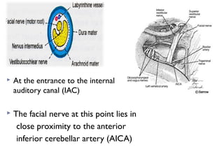  At the entrance to the internal
auditory canal (IAC)
 The facial nerve at this point lies in
close proximity to the anterior
inferior cerebellar artery (AICA)
 