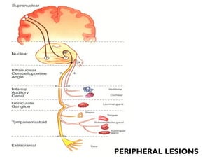 PERIPHERAL LESIONS
 