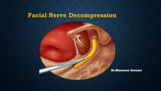 Facial Nerve Decompression
Dr.Mamoon Ameen
 