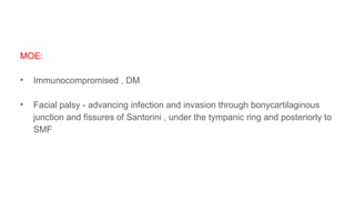 MOE:
• Immunocompromised , DM
• Facial palsy - advancing infection and invasion through bonycartilaginous
junction and fissures of Santorini , under the tympanic ring and posteriorly to
SMF
 