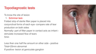 Topodiagnostic tests
To know the site of lesion
1. Schirmer test-
Folded strip of sterile filter paper is placed into
conjunctival fornix of each eye- compare rate of tear
production on both sides
Normally- part of filter paper in contact acts as irritant -
stimulate increased flow of tears
5min
Less than one half the amount on other side - positive
Total<25mm abnormal
If positive- lesion at geniculate ganglion
 