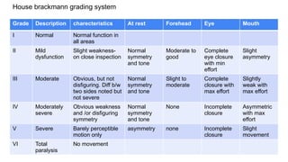 House brackmann grading system
Grade Description charecteristics At rest Forehead Eye Mouth
I Normal Normal function in
all areas
II Mild
dysfunction
Slight weakness-
on close inspection
Normal
symmetry
and tone
Moderate to
good
Complete
eye closure
with min
effort
Slight
asymmetry
III Moderate Obvious, but not
disfiguring. Diff b/w
two sides noted but
not severe
Normal
symmetry
and tone
Slight to
moderate
Complete
closure with
max effort
Slightly
weak with
max effort
IV Moderately
severe
Obvious weakness
and /or disfiguring
symmetry
Normal
symmetry
and tone
None Incomplete
closure
Asymmetric
with max
effort
V Severe Barely perceptible
motion only
asymmetry none Incomplete
closure
Slight
movement
VI Total
paralysis
No movement
 
