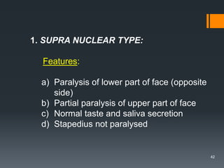 1. SUPRA NUCLEAR TYPE:
Features:
a) Paralysis of lower part of face (opposite
side)
b) Partial paralysis of upper part of face
c) Normal taste and saliva secretion
d) Stapedius not paralysed
42
 
