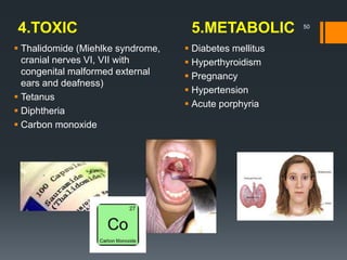 4.TOXIC 5.METABOLIC 50
 Thalidomide (Miehlke syndrome,
cranial nerves VI, VII with
congenital malformed external
ears and deafness)
 Tetanus
 Diphtheria
 Carbon monoxide
 Diabetes mellitus
 Hyperthyroidism
 Pregnancy
 Hypertension
 Acute porphyria
 