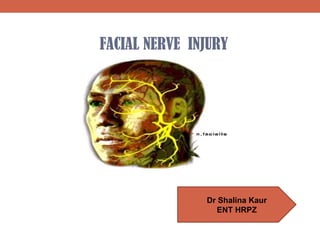 FACIAL NERVE INJURY
Dr Shalina Kaur
ENT HRPZ
 