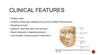  Sudden onset
 Unable to close eyes, eyeball turns up and out (Bell’s Phenomenon)
 Drooping of mouth
 Epiphora ( tears flow down from the eye )
 Noise intolerance ( stapedial paralysis )
 Loss of taste ( chorda tympani involvement )
 