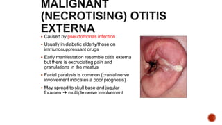  Caused by pseudomonas infection
 Usually in diabetic elderly/those on
immunosuppressant drugs
 Early manifestation resemble otitis externa
but there is excruciating pain and
granulations in the meatus
 Facial paralysis is common (cranial nerve
involvement indicates a poor prognosis)
 May spread to skull base and jugular
foramen  multiple nerve involvement
 
