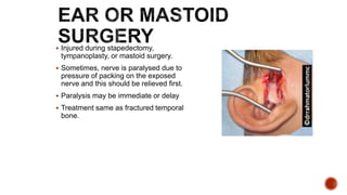  Injured during stapedectomy,
tympanoplasty, or mastoid surgery.
 Sometimes, nerve is paralysed due to
pressure of packing on the exposed
nerve and this should be relieved first.
 Paralysis may be immediate or delay
 Treatment same as fractured temporal
bone.
 