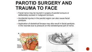  Facial nerve may be injured in surgery of parotid tumours or
deliberately excised in malignant tumours.
 Accidental injuries in the parotid region can also cause facial
paralysis.
 Application of obstetrical forceps may also result in facial paralysis
in the neonate due to pressure on the extratemporal part of nerve.
 