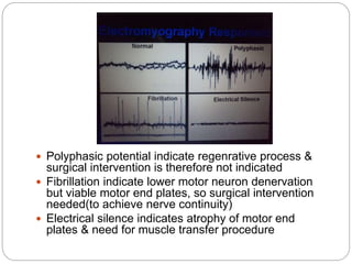 Facial nerve palsy | PPTX
