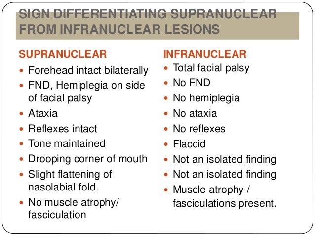 Facial nerve palsy