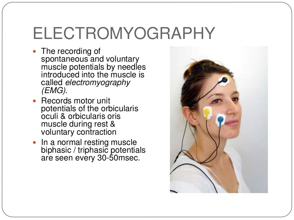 Facial nerve palsy