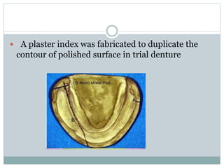 Facial nerve palsy | PPTX