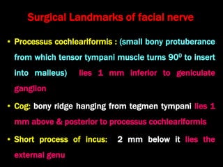 • Processus cochleariformis : (small bony protuberance
from which tensor tympani muscle turns 900 to insert
into malleus) lies 1 mm inferior to geniculate
ganglion
• Cog: bony ridge hanging from tegmen tympani lies 1
mm above & posterior to processus cochleariformis
• Short process of incus: 2 mm below it lies the
external genu
Surgical Landmarks of facial nerve
 