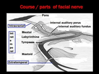 Course / parts of facial nerve
 