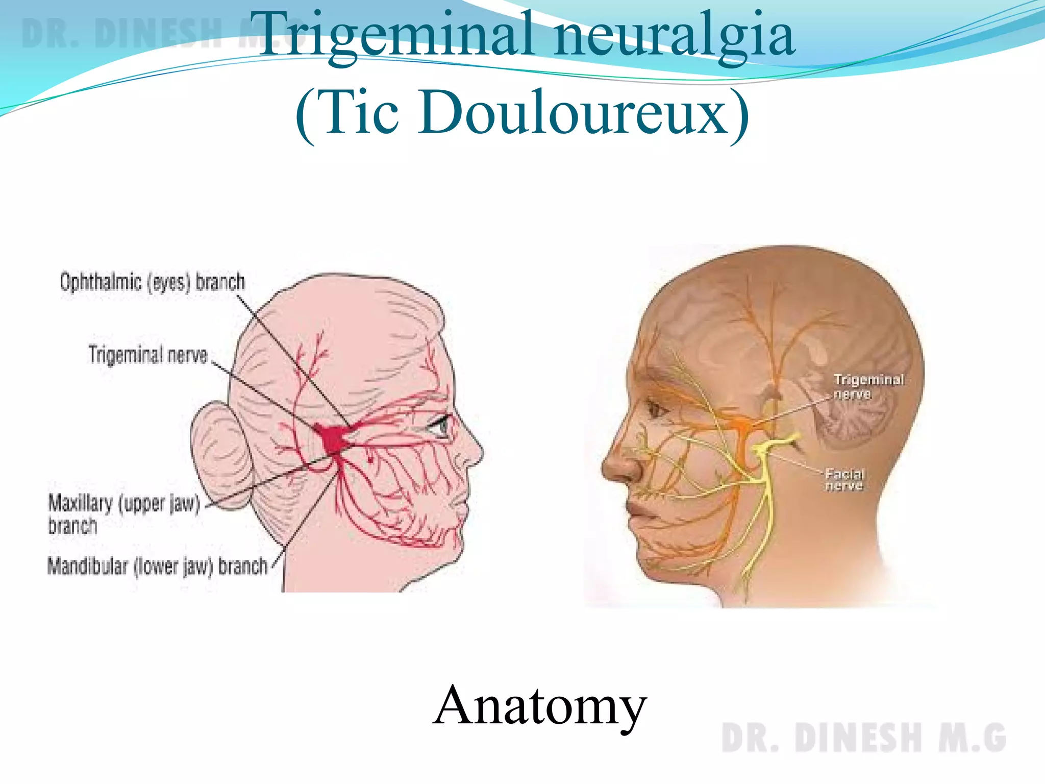 Facial nerve palsy & Trigeminal neuralgia | PDF