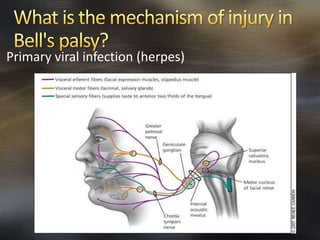 Primary viral infection (herpes) 
 