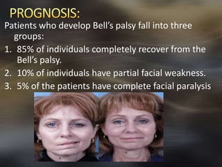 Patients who develop Bell’s palsy fall into three 
groups: 
1. 85% of individuals completely recover from the 
Bell’s palsy. 
2. 10% of individuals have partial facial weakness. 
3. 5% of the patients have complete facial paralysis 
 