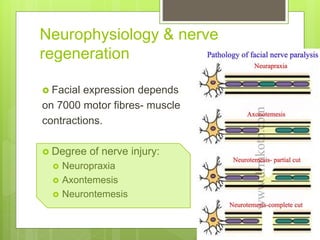 Neurophysiology & nerve
regeneration
 Facial expression depends
on 7000 motor fibres- muscle
contractions.
 Degree of nerve injury:
 Neuropraxia
 Axontemesis
 Neurontemesis
 