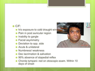  C/F:
 h/o exposure to cold draught wind
 Pain in post auricular region
 Inability to gargle
 Facial asymmetry
 Deviation to opp. side
 Acute & unilateral
 Numbness/ weakness
 Dec lacrimation & salivation
 90% absence of stapedial reflex
 Chorda tympani- red on otoscopic exam. Within 10
days of onset
 