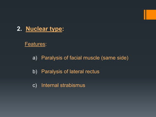2. Nuclear type:
Features:
a) Paralysis of facial muscle (same side)
b) Paralysis of lateral rectus
c) Internal strabismus

 