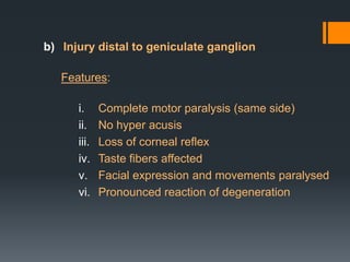 b) Injury distal to geniculate ganglion
Features:
i.
ii.
iii.
iv.
v.
vi.

Complete motor paralysis (same side)
No hyper acusis
Loss of corneal reflex
Taste fibers affected
Facial expression and movements paralysed
Pronounced reaction of degeneration

 