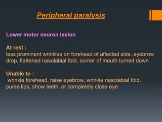 Peripheral paralysis
Lower motor neuron lesion
At rest :
less prominent wrinkles on forehead of affected side, eyebrow
drop, flattened nasolabial fold, corner of mouth turned down
Unable to :
wrinkle forehead, raise eyebrow, wrinkle nasolabial fold,
purse lips, show teeth, or completely close eye

 