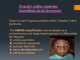 Treacher collins syndrome
(mandibulo facial dysostosis)
There is a set of typical symptoms within Treacher Collins
Syndrome
The OMENS classification was developed as a
comprehensive and stage-based approach to differentiate
the diseases.
O; orbital asymmetry
M; mandibular hypoplasia
E; auricular deformity
N; nerve development and
S; soft-tissue disease

 