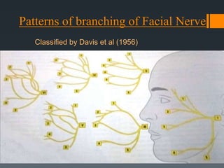 Patterns of branching of Facial Nerve
Classified by Davis et al (1956)

 