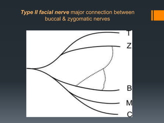 Type II facial nerve major connection between
buccal & zygomatic nerves

 