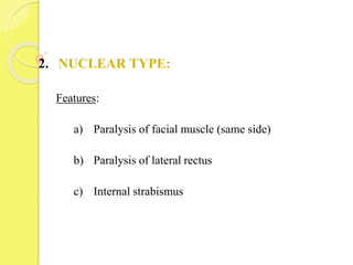 2. NUCLEAR TYPE:
Features:
a) Paralysis of facial muscle (same side)
b) Paralysis of lateral rectus
c) Internal strabismus
 