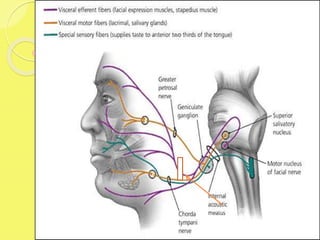 Lesion at int
acoustic meatus
 