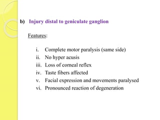 b) Injury distal to geniculate ganglion
Features:
i. Complete motor paralysis (same side)
ii. No hyper acusis
iii. Loss of corneal reflex
iv. Taste fibers affected
v. Facial expression and movements paralysed
vi. Pronounced reaction of degeneration
 