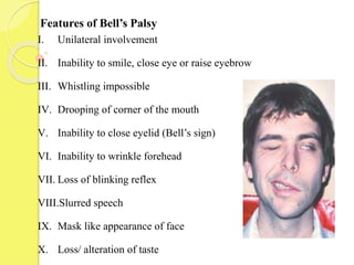 I. Unilateral involvement
II. Inability to smile, close eye or raise eyebrow
III. Whistling impossible
IV. Drooping of corner of the mouth
V. Inability to close eyelid (Bell’s sign)
VI. Inability to wrinkle forehead
VII. Loss of blinking reflex
VIII.Slurred speech
IX. Mask like appearance of face
X. Loss/ alteration of taste
Features of Bell’s Palsy
 