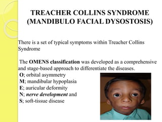 TREACHER COLLINS SYNDROME
(MANDIBULO FACIAL DYSOSTOSIS)
There is a set of typical symptoms within Treacher Collins
Syndrome
The OMENS classification was developed as a comprehensive
and stage-based approach to differentiate the diseases.
O; orbital asymmetry
M; mandibular hypoplasia
E; auricular deformity
N; nerve development and
S; soft-tissue disease
 
