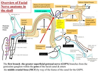Overview of Facial
Nerve anatomy in
the skull
Lacerate foramen
Internal
Acoustic
Meatus
Stylomastoid
Foramen
Hiatus of canal of greater
superficial petrosal nerve
Pterygoid canalGreater
superficial
Petrosal
nerve
(GSPN)
Petrotympanic
fissure
Greater and
lesser palatine
canals
Chorda tympani
Facial nerve
Facial nerve
Posterior
Cranial
Fossa
Inferior Orbital Fissure
The first branch -the greater superficial petrosal nerve (GSPN) branches from the
geniculate ganglion within the genu of the facial canal & enters
the middle cranial fossa (MCF) by way of the hiatus of the canal for the GSPN.
Geniculate ganglion
Facial
canal
MCF
 