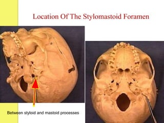 Location Of The Stylomastoid Foramen
Between styloid and mastoid processes
 