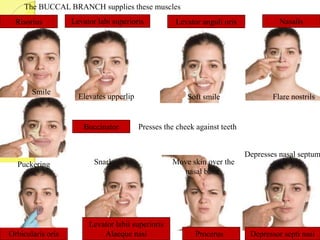 Risorius
Buccinator
Levator labi superioris Levator anguli oris Nasalis
Orbicularis oris Depressor septi nasiProcerus
The BUCCAL BRANCH supplies these muscles
Levator labii superioris
Alaeque nasi
Elevates upperlip
Snarl
Soft smile Flare nostrils
Puckering Move skin over the
nasal bone
Depresses nasal septum
Presses the cheek against teeth
Smile
 