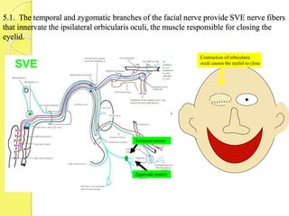 5.1. The temporal and zygomatic branches of the facial nerve provide SVE nerve fibers
that innervate the ipsilateral orbicularis oculi, the muscle responsible for closing the
eyelid.
Temporal branch
Zygomatic branch
SVE
Contraction of orbicularis
oculi causes the eyelid to close
 