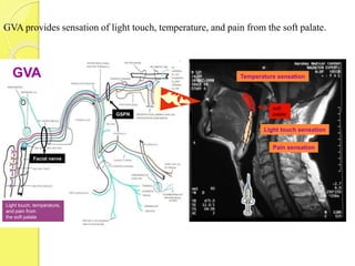 GVA provides sensation of light touch, temperature, and pain from the soft palate.
soft
palate
Light touch, temperature,
and pain from
the soft palate
GVA
Light touch sensation
Temperature sensation
Pain sensation
GSPN
Facial nerve
 