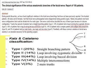 Straight branching pattern
Loop involving zygomatic division
Loop involving buccal division
Multiple interconnections
2 main trunks
 