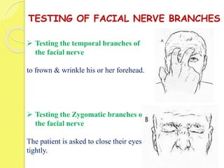 TESTING OF FACIAL NERVE BRANCHES
 Testing the temporal branches of
the facial nerve
to frown & wrinkle his or her forehead.
 Testing the Zygomatic branches of
the facial nerve
The patient is asked to close their eyes
tightly.
 