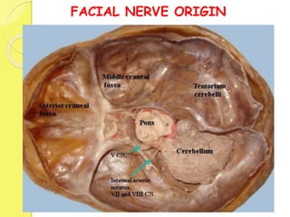 FACIAL NERVE ORIGIN
 